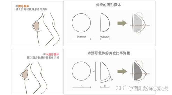 最新隆胸方法探索，现代丰胸技术的新领域